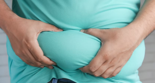 Obesitas (Overweight) Bisa Sebabkan Penyakit Jantung