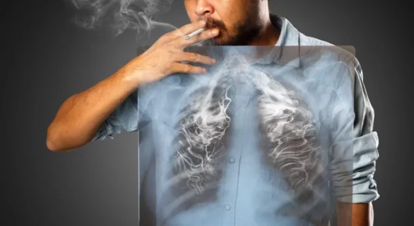 Bahaya Itu TAR Dan Bukan Nikotin Pada Rokok