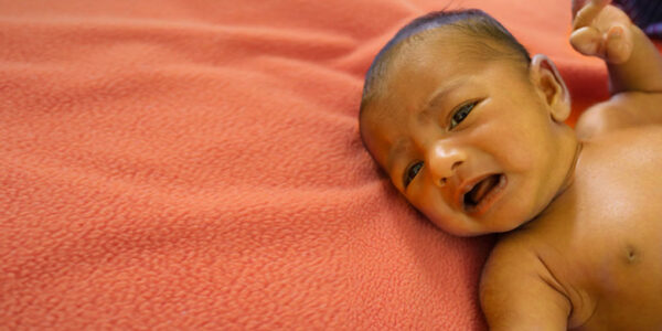 Penyakit Kuning Pada Bayi Yang Umumnya Terkena Ketika Lahir